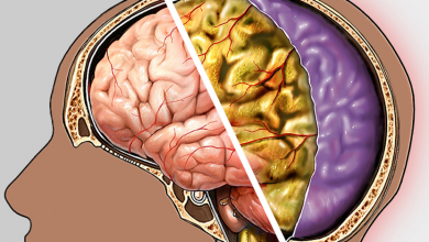 Menenjit Nedir? Menenjit Belirtileri ve Tedavisi